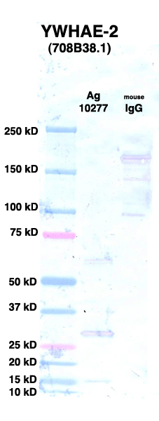Click to enlarge image Western Blot using CPTC-YWHAE-2 as primary Ab against rYWHAE Ag (NCI-10277) in lane 2. Also included are molecular wt. standards (lane 1) and mouse IgG control (lane 3).