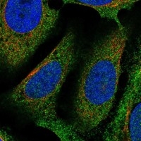 Click to enlarge image Results provided by the Human Protein Atlas (www.proteinatlas.org).  The subcellular location is partly supported by literature or no literature is available. Immunofluorescent staining of human cell line U-2 OS shows localization to cytosol. Human assay: HeLa fixed with PFA, dilution: 1:9
Human assay: MCF7 fixed with PFA, dilution: 1:9
Human assay: U-2 OS fixed with PFA, dilution: 1:9