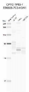 Click to enlarge image Western Blot using CPTC-TP53-1 as primary antibody against cell lysates LCL57 (lane 2), HeLa (lane 3) and MCF10A (lane 4). Also included are molecular weight standards (lane 1).
