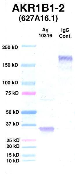 Click to enlarge image Western Blot using CPTC-AKR1B1-2 as primary Ab against Ag 10316 (lane 2). Also included are molecular wt. standards (lane 1) and mouse IgG control (lane 3).