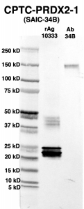 Click to enlarge image Western Blot using CPTC-PRDX2-1 as primary Ab against full-length recombinant Ag 10333 (lane 2). Also included are molecular wt. standards (lane 1) and the PRDX2-1 Ab as positive control (lane 3).