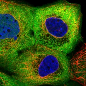 Click to enlarge image Results provided by the Human Protein Atlas (www.proteinatlas.org). The subcellular location is supported by literature. Immunofluorescent staining of human cell line A-431 shows localization to plasma membrane & cytosol. 
Human assay: A-431 fixed with PFA, dilution: 1:150
Human assay: U-2 OS fixed with PFA, dilution: 1:150
Human assay: U-251 MG fixed with PFA, dilution: 1:150