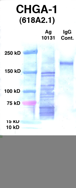 Click to enlarge image Western Blot using CPTC-CHGA-1 as primary Ab against Ag 10131 (lane 2). Also included are molecular wt. standards (lane 1) and mouse IgG control (lane 3).
