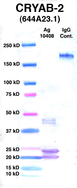 Click to enlarge image Western Blot using CPTC-CRYAB-2 as primary Ab against Ag 10408 (lane 2). Also included are molecular wt. standards (lane 1) and mouse IgG control (lane 3).