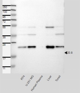 Click to enlarge image Results provided by the Human Protein Atlas (www.proteinatlas.org).  Band of predicted size in kDa (+/-20%) with additional bands present. Analysis performed using a standard panel of samples. Antibody dilution: 1:250.
