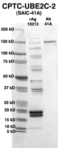 Click to enlarge image Western Blot using CPTC-UBE2C-2 as primary Ab against full-length recombinant Ag 10213 (lane 2). Also included are molecular wt. standards (lane 1) and the UBE2C-2 Ab as positive control (lane 3).