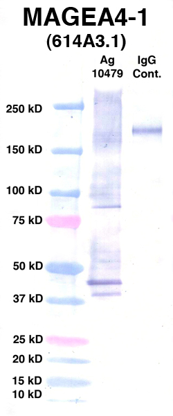 Click to enlarge image Western Blot using CPTC-MAGEA4-1 as primary Ab against Ag 10479 (lane 2).
Also included are molecular wt. standards (lane 1) and mouse IgG control (lane 3).