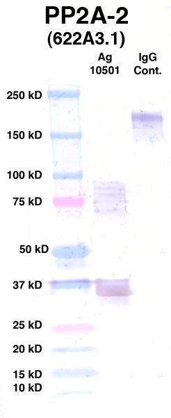 Click to enlarge image Western Blot using CPTC-PP2A-2 as primary Ab against Ag 10501 (lane 2). Also included are molecular wt. standards (lane 1) and mouse IgG control (lane 3).