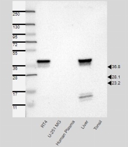 Click to enlarge image Results provided by the Human Protein Atlas (www.proteinatlas.org).  Band of predicted size in kDa (+/-20%) with additional bands present. Analysis performed using a standard panel of samples. Antibody dilution: 1:500