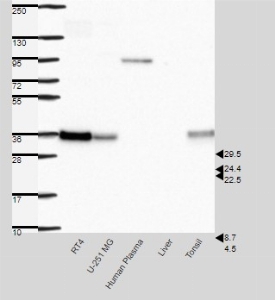 Click to enlarge image Results provided by the Human Protein Atlas (www.proteinatlas.org). Band of predicted size in kDa (+/-20%) with additional bands present. Analysis performed using a standard panel of samples. Antibody dilution: 1:500