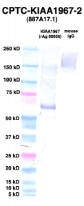Click to enlarge image Western Blot using CPTC-KIAA1967-2 as primary Ab against KIAA1967 (rAg 00056) (lane 2). Also included are molecular wt. standards (lane 1) and mouse IgG control (lane 3).