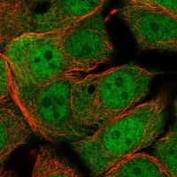 Click to enlarge image Results provided by the Human Protein Atlas (www.proteinatlas.org).  The subcellular location is partly supported by literature or no literature is available. Immunofluorescent staining of human cell line MCF7 shows localization to nucleoplasm & cytosol. 
Human assay: HeLa fixed with PFA, dilution: 1:2000
Human assay: MCF7 fixed with PFA, dilution: 1:2000
Human assay: U-2 OS fixed with PFA, dilution: 1:2000