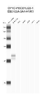 Click to enlarge image Automated western blot using CPTC-PDCD1LG2-1 as primary antibody against buffy coat (lane 2), HeLa (lane 3), Jurkat (lane 4), A549 (lane 5), MCF7 (lane 6), and H226 (lane 7) cell lysates.  Expected molecular weight - 31 kDa.  Molecular weight standards are also included (lane 1). Data is positive for buffy coat. Data is negative for remaining cell lines.