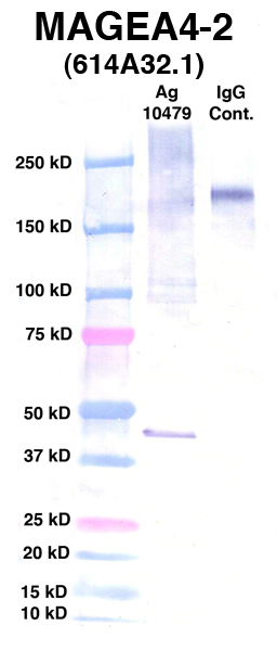 Click to enlarge image Western Blot using CPTC-MAGEA4-2 as primary Ab against Ag 10479 (lane 2).
Also included are molecular wt. standards (lane 1) and mouse IgG control (lane 3).
