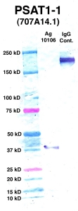 Click to enlarge image Western Blot using CPTC-PSAT1-1 as primary Ab against PSAT1 (Ag 10106) (lane 2). Also included are molecular wt. standards (lane 1) and mouse IgG control (lane 3).