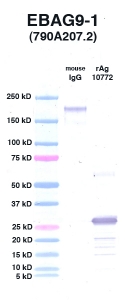Click to enlarge image Western Blot using CPTC-EBAG9-1 as primary Ab against EBAG9 (rAg 10772) in lane 3. Also included are molecular wt. standards (lane 1) and mouse IgG control (lane 2).