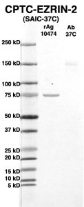 Click to enlarge image Western Blot using CPTC-EZRIN-2 as primary Ab against full-length recombinant Ag 10474 (lane 2). Also included are molecular wt. standards (lane 1) and the EZRIN-2 Ab as positive control (lane 3).