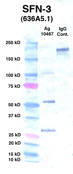 Click to enlarge image Western Blot using CPTC-SFN-3 as primary Ab against Ag 10467 (lane 2). Also included are molecular wt. standards (lane 1) and mouse IgG control (lane 3).