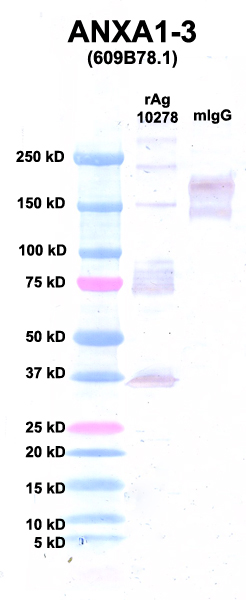 Click to enlarge image Western Blot using CPTC-ANXA1-3 as primary Ab against Ag 10278 (lane 2). Also included are molecular wt. standards (lane 1) and mouse IgG control (lane 3).