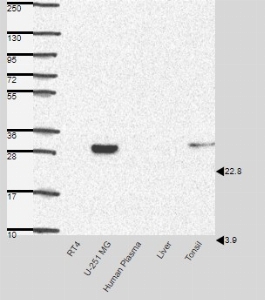 Click to enlarge image Results provided by the Human Protein Atlas (www.proteinatlas.org). Single band differing more than +/-20% from predicted size in kDa and not supported by experimental and/or bioinformatic data. Analysis performed using a standard panel of samples. Antibody dilution: 1:500.