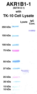 Click to enlarge image Western Blot using CPTC-AKR1B1-1 as primary Ab against cell lysate from TK-10 cells (lane 2). Also included are molecular wt. standards (lane 1) and mouse IgG control (lane 3).