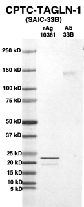 Click to enlarge image Western Blot using CPTC-TAGLN-1 as primary Ab against full-length recombinant Ag 10361 (lane 2). Also included are molecular wt. standards (lane 1) and the TAGLN-1 Ab as positive control (lane 3).