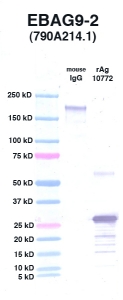 Click to enlarge image Western Blot using CPTC-EBAG9-2 as primary Ab against EBAG9 (rAg 10772) in lane 3. Also included are molecular wt. standards (lane 1) and mouse IgG control (lane 2).