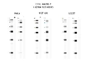 Click to enlarge image Automated western blot using CPTC-RAD50-2 as primary antibody against cell lysates HeLa, MCF10A, and LCL57.  Samples from each cell line were irradiated with 10 Gy as shown in ‘+’ indicated lanes. Samples from each non-irradiated cell line were treated with alkaline phosphatase enzyme as shown in ‘-‘ indicated lanes.  Molecular weight standards are included for each cell line.