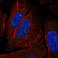 Click to enlarge image Results provided by the Human Protein Atlas (www.proteinatlas.org).
The subcellular location is partly supported by literature or no literature is available. Immunofluorescent staining of human cell line U2OS shows localization to nuclear bodies.

Human assay: THP-1 fixed with PFA, dilution: 1:200
Human assay: U2OS fixed with PFA, dilution: 1:200