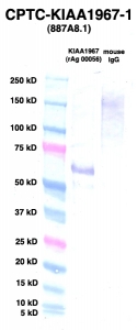 Click to enlarge image Western Blot using CPTC-KIAA1967-1 as primary Ab against KIAA1967 (rAg 00056) (lane 2). Also included are molecular wt. standards (lane 1) and mouse IgG control (lane 3).