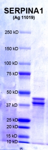 Click to enlarge image PAGE of Ag 11019 (with molecular weight standards in lane 1)