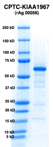 Click to enlarge image PAGE of KIAA1967 (rAg 00056) with molecular weight standards in lane 1 