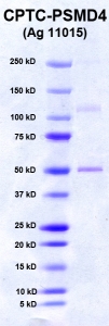 Click to enlarge image PAGE of PSMD4 (Ag 11015) with molecular weight standards in lane 1