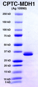Click to enlarge image PAGE of MDH1 (Ag 10990) in Lane 2 with molecular weight standards in lane 1