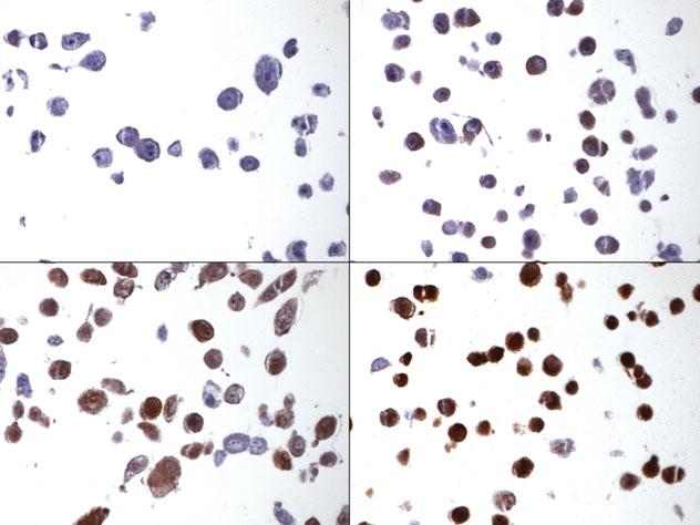 IHC NCI60 Cell Line Array example