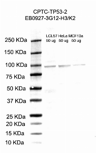 Click to enlarge image Western Blot using CPTC-TP53-2 as primary antibody against cell lysates LCL57 (lane 2), HeLa (lane 3) and MCF10A (lane 4). Also included are molecular weight standards (lane 1).