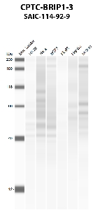 Click to enlarge image Automated western blot using CPTC-BRIP1-3 as primary antibody against HT-29 (lane 2), HeLa (lane 3), MCF7 (lane 4), HL-60 (lane 5), Hep G2 (lane 6), and MCF7 (lane 7) whole cell lysates.  Expected molecular weight - 141 kDa and 112 kDa.  Molecular weight standards are also included (lane 1).