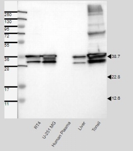 Click to enlarge image Results provided by the Human Protein Atlas (www.proteinatlas.org). Band of predicted size in kDa (+/-20%) with additional bands present. Analysis performed using a standard panel of samples. Antibody dilution: 1:500.