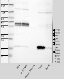 Click to enlarge image Results provided by the Human Protein Atlas (www.proteinatlas.org). Band of predicted size in kDa (+/-20%) with additional bands present. Analysis performed using a standard panel of samples. Antibody dilution: 1:500