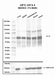 Click to enlarge image Western blot using CPTC-IFIT3-1 as primary antibody against human lung (2), spleen (3), endometrium (4), breast (5), and ovary (6) tissue lysates. The expected molecular weight is 56.0 kDa. Vinculin was used as a loading control.