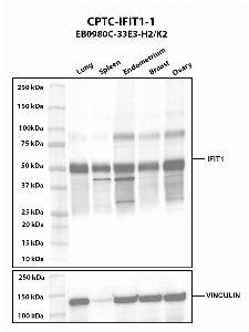 Click to enlarge image Western blot using CPTC-IFIT1-1 as primary antibody against human lung (2), spleen (3), endometrium (4), breast (5), and ovary (6) tissue lysates. The expected molecular weight is 55.4 kDa and 51.7 kDa. Vinculin was used as a loading control.