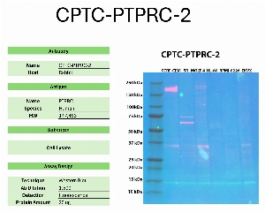 Click to enlarge image Western blot using CPTC-PTPRC-2 as primary antibody against the whole lysates of CCRF-CEM, SR, MOLT-4, HL-60, RPMI-8226, and EKVX. The antibody detected the target protein (~147.5 KDa) in CCRF-CEM cell lysate.