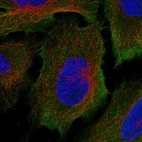 Click to enlarge image Results provided by the Human Protein Atlas (www.proteinatlas.org).

The subcellular location is supported by literature. Immunofluorescent staining of human cell line U2OS shows localization to plasma membrane. Human assay: 
THP-1 fixed with PFA, dilution: 1:100
Human assay: U2OS fixed with PFA, dilution: 1:100