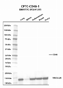 Click to enlarge image Western blot using CPTC-CD48-1 as primary antibody against human lung (2), spleen (3), endometrium (4), breast (5), and ovary (6) tissue lysates. The expected molecular weight is 27.9 kDa. Vinculin was used as a loading control.