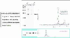 Click to enlarge image Automated WB (Simple Western) using CPTC-SIGLEC9-1 as primary antibody against the whole lysate of breast, ovary, spleen, endometrium and lung tissues. Expected MW is 50.1 KDa. The antibody recognizes the target in breast, ovary adn endometrium tissue lysates. The same cell lysates were probed with an anti-CytC antibody (bottom panel).