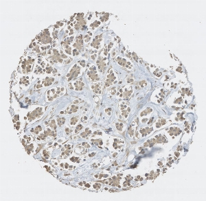Click to enlarge image Tissue Micro-Array (TMA) core of breast cancer showing cytoplasmic staining using Antibody CPTC-ABCB1-1. Titer: 1:5000
