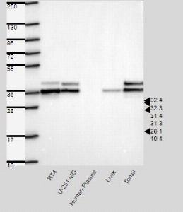 Click to enlarge image Results provided by the Human Protein Atlas (www.proteinatlas.org).  Single band corresponding to the predicted size in kDa (+/-20%). Analysis performed using a standard panel of samples. Antibody dilution: 1:500.