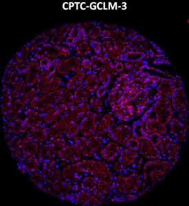 Click to enlarge image Imaging mass cytometry on normal kidney tissue core using CPTC-GCLM-3 metal-labeled antibody.  Data shows an overlay of the target protein signal (red) and DNA (blue). Dilution: 1:100 of 0.5mg/mL stock. Signal was also obtained in other normal tissues (liver, bone marrow, prostate, colon, pancreas, breast, lung, testis, endometrium, appendix, and kidney) and cancer tissues (colon, breast, ovarian, lung, and prostate).