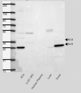 Click to enlarge image Results provided by the Human Protein Atlas (www.proteinatlas.org).  Band of predicted size in kDa (+/-20%) with additional bands present. Analysis performed using a standard panel of samples. Antibody dilution: 1:500