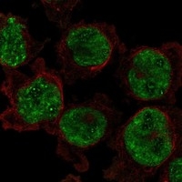 Click to enlarge image The evaluation results as provided by the Human Protein Atlas (www.proteinatlas.org). The subcellular location is supported by literature. Immunofluorescent staining of human cell line THP-1 shows localization to nucleoplasm & nucleoli fibrillar center.

Human assay: THP-1 fixed with PFA, dilution: 1:150
Human assay: U2OS fixed with PFA, dilution: 1:150